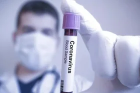 xtest-coronavirus-g.jpg.pagespeed.ic_.qkk8s0rfu5_1.jpg