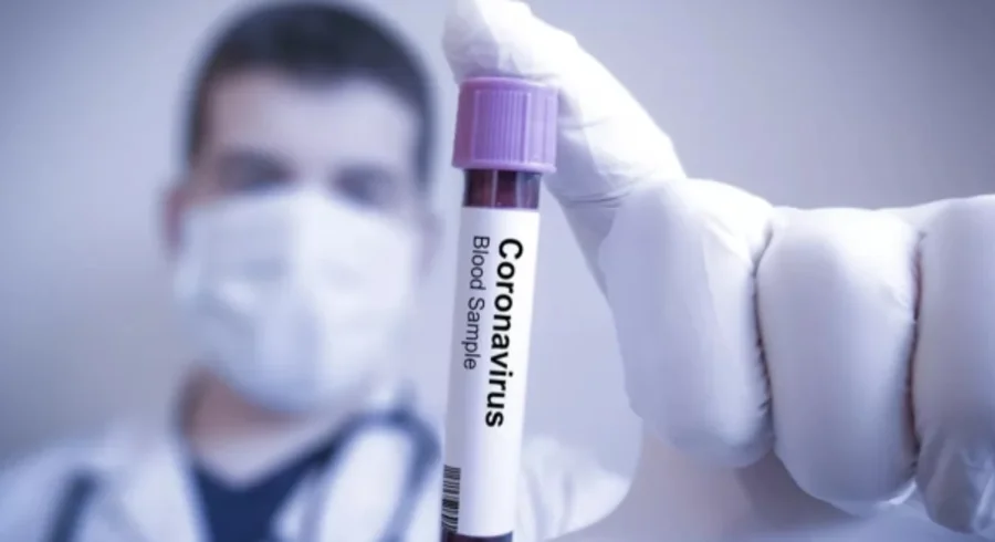 xtest-coronavirus-g.jpg.pagespeed.ic_.qkk8s0rfu5.jpg