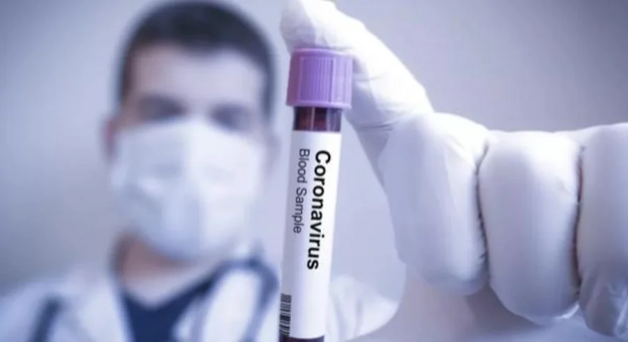 xtest-coronavirus-g.jpg.pagespeed.ic_.qkk8s0rfu5_1.jpg