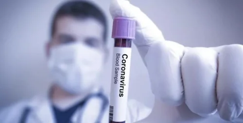 xtest-coronavirus-g.jpg.pagespeed.ic_.qkk8s0rfu5_1.jpg